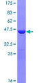 MDP-1 Protein - 12.5% SDS-PAGE of human MGC5987 stained with Coomassie Blue