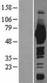 ME1 / Malate Dehydrogenase Protein - Western validation with an anti-DDK antibody * L: Control HEK293 lysate R: Over-expression lysate