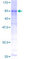 ME1 / Malate Dehydrogenase Protein - 12.5% SDS-PAGE of human ME1 stained with Coomassie Blue