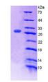 MED1 / TRAP220 Protein - Recombinant Mediator Complex Subunit 1 By SDS-PAGE