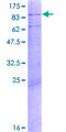 MED17 / TRAP80 Protein - 12.5% SDS-PAGE of human MED17 stained with Coomassie Blue