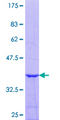 MED22 Protein - 12.5% SDS-PAGE Stained with Coomassie Blue.
