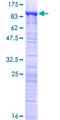 MED26 / CRSP7 Protein - 12.5% SDS-PAGE of human MED26 stained with Coomassie Blue