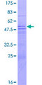 MED8 Protein - 12.5% SDS-PAGE of human MED8 stained with Coomassie Blue