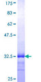 MED8 Protein - 12.5% SDS-PAGE Stained with Coomassie Blue