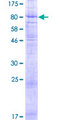 MFSD6L Protein - 12.5% SDS-PAGE of human FLJ35773 stained with Coomassie Blue