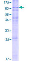 MFSD7 Protein - 12.5% SDS-PAGE of human MFSD7 stained with Coomassie Blue