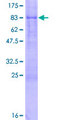 MIDN Protein - 12.5% SDS-PAGE of human MIDN stained with Coomassie Blue