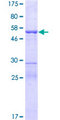 MIF4GD Protein - 12.5% SDS-PAGE of human MIF4GD stained with Coomassie Blue