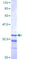 MKRN1 Protein - 12.5% SDS-PAGE Stained with Coomassie Blue.