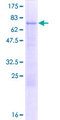 MLR2 / LCOR Protein - 12.5% SDS-PAGE of human LCOR stained with Coomassie Blue