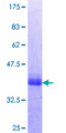 MLX / TCFL4 Protein - 12.5% SDS-PAGE Stained with Coomassie Blue.