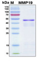 MMP19 Protein - SDS-PAGE under reducing conditions and visualized by Coomassie blue staining