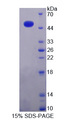MMP19 Protein - Recombinant  Matrix Metalloproteinase 19 By SDS-PAGE