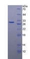 MMP24 Protein - Recombinant Matrix Metalloproteinase 24 By SDS-PAGE