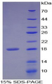MMP3 Protein - Recombinant Matrix Metalloproteinase 3 By SDS-PAGE