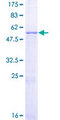 MMS19 Protein - 12.5% SDS-PAGE of human MMS19L stained with Coomassie Blue