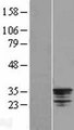 MMS21 / NSMCE2 Protein - Western validation with an anti-DDK antibody * L: Control HEK293 lysate R: Over-expression lysate