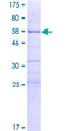 MMS21 / NSMCE2 Protein - 12.5% SDS-PAGE of human NSMCE2 stained with Coomassie Blue