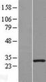 MORN3 Protein - Western validation with an anti-DDK antibody * L: Control HEK293 lysate R: Over-expression lysate