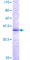 MPP2 Protein - 12.5% SDS-PAGE Stained with Coomassie Blue.