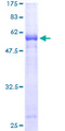 MPPED1 Protein - 12.5% SDS-PAGE of human C22orf1 stained with Coomassie Blue