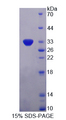 MPS1 / TTK Protein - Recombinant  TTK Protein Kinase By SDS-PAGE