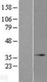 MRO Protein - Western validation with an anti-DDK antibody * L: Control HEK293 lysate R: Over-expression lysate