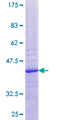 MRPL20 Protein - 12.5% SDS-PAGE of human MRPL20 stained with Coomassie Blue