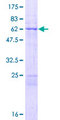 MRPL44 Protein - 12.5% SDS-PAGE of human MRPL44 stained with Coomassie Blue