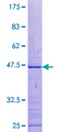MRPL49 Protein - 12.5% SDS-PAGE of human MRPL49 stained with Coomassie Blue