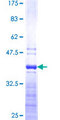 MRPL49 Protein - 12.5% SDS-PAGE Stained with Coomassie Blue.