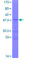 MRPS11 Protein - 12.5% SDS-PAGE of human MRPS11 stained with Coomassie Blue