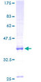 MRPS17 Protein - 12.5% SDS-PAGE of human MRPS17 stained with Coomassie Blue
