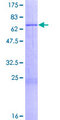 MRPS9 Protein - 12.5% SDS-PAGE of human MRPS9 stained with Coomassie Blue