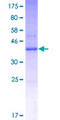 MS4A15 Protein - 12.5% SDS-PAGE of human MGC35295 stained with Coomassie Blue