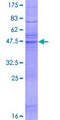 MS4A5 Protein - 12.5% SDS-PAGE of human MS4A5 stained with Coomassie Blue