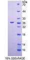 MSRA Protein - Recombinant  Methionine Sulfoxide Reductase A By SDS-PAGE