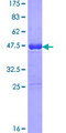 MSRB3 Protein - 12.5% SDS-PAGE of human MSRB3 stained with Coomassie Blue