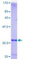 MT1F Protein - 12.5% SDS-PAGE of human MT1F stained with Coomassie Blue