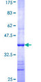 MTERF1 Protein - 12.5% SDS-PAGE Stained with Coomassie Blue.