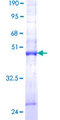 MTFP1 Protein - 12.5% SDS-PAGE of human MTP18 stained with Coomassie Blue