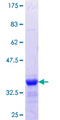 MTMR1 Protein - 12.5% SDS-PAGE Stained with Coomassie Blue.