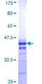 MTMR2 Protein - 12.5% SDS-PAGE Stained with Coomassie Blue.