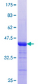 MTMR3 Protein - 12.5% SDS-PAGE Stained with Coomassie Blue.