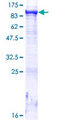 MTMR8 Protein - 12.5% SDS-PAGE of human MTMR8 stained with Coomassie Blue
