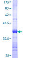 MTRR Protein - 12.5% SDS-PAGE Stained with Coomassie Blue