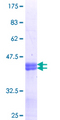MXI1 / MAD2 Protein - 12.5% SDS-PAGE Stained with Coomassie Blue.