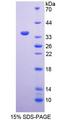 MXRA5 Protein - Recombinant  Matrix Remodelling Associated Protein 5 By SDS-PAGE