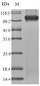 MYL3 Protein - (Tris-Glycine gel) Discontinuous SDS-PAGE (reduced) with 5% enrichment gel and 15% separation gel.